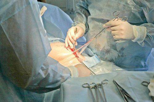 Sản phụ đến bệnh viện khi đã quá ngày dự sinh, bác sĩ lắc đầu khi lấy bé ra - 2
