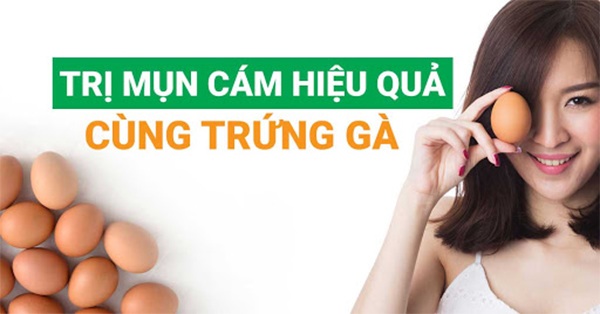 12 Cách trị mụn cám tại nhà hiệu quả nhanh nhất từ thiên nhiên - 4