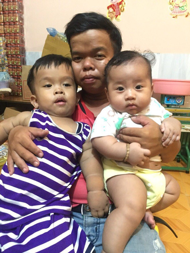 Lỡ có bầu với chàng lùn 1m2, nữ sinh ĐH Y nịt bụng lên giảng đường, hồi hộp đi đẻ - 2