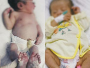 Sức khỏe - Bé sơ sinh vừa chào đời đã mắc bệnh giang mai, bác sĩ cảnh báo các mẹ bầu
