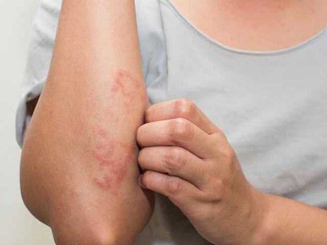 Những bộ phận trên cơ thể bị ngứa nên đi khám sớm, cẩn thận có thể là ung thư