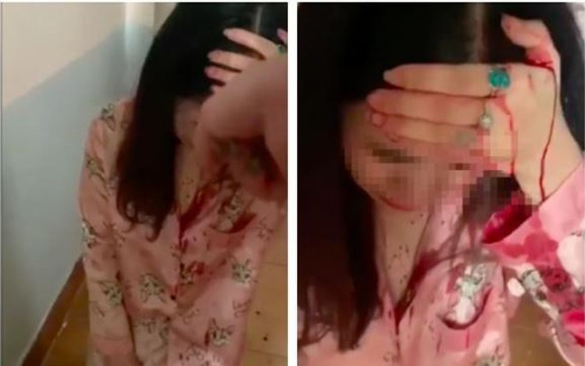 Tin tức 24h: Bị vợ của nhân tình đánh ghen, cô gái liên tục van xin “Cháu xin lỗi cô” - 1