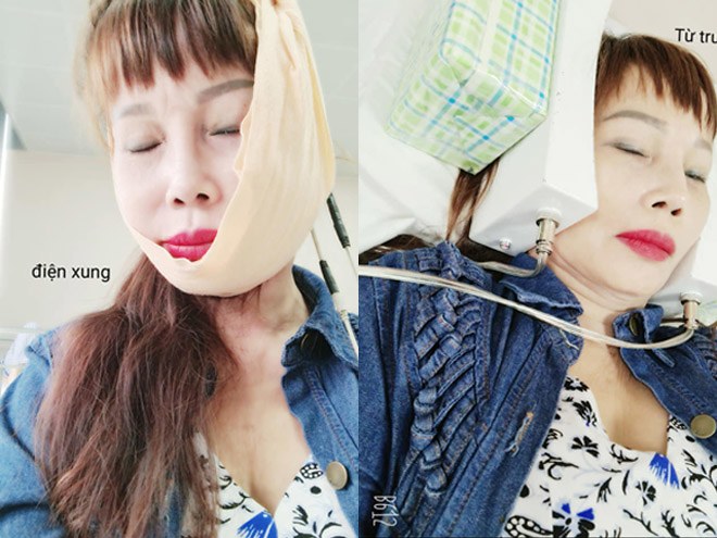 Cô dâu Thu Sao tiết lộ: “May chị đi khám, bác sĩ nói để lâu là méo miệng cả đời” - 1