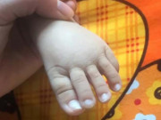 Làm mẹ - Ảnh ngón chân dài như tay của con mới sinh gây sốc, người mẹ cuối cùng thú nhận sự thật