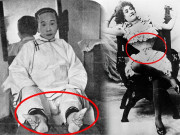 Làm đẹp - Rợn gáy các tiêu chuẩn làm đẹp của phụ nữ xa xưa, có người cắt máu để làm trắng da