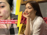 Làm đẹp - Hòa Minzy mỗi lần skincare hơn 1 tiếng, thanh lý cả rổ mụn nhờ chú trọng bước làm sạch