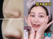 Làm đẹp - Đừng lột mụn đầu đen nữa, dùng vaseline và dầu tẩy trang vừa hiệu quả lại bớt đau đớn