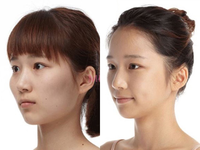 Sự thật về phụ nữ có gò má cao kiếm cả đời không được chồng, lấy được thì sát phu