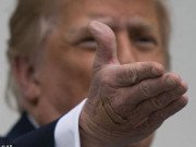 Tin tức - Bức ảnh tiết lộ dấu hiệu lạ trên bàn tay ông Trump