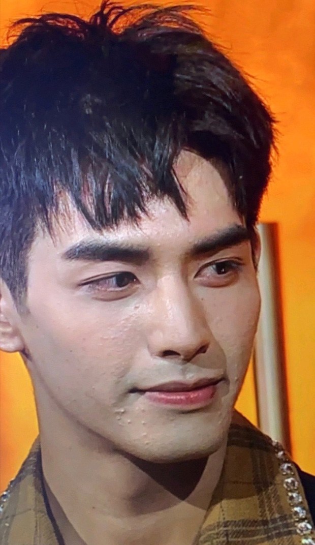 Ngôi sao 24/7: Mỹ nam Cbiz bị bóc nhan sắc thật làn da sần sùi mụn đến gai người - 1