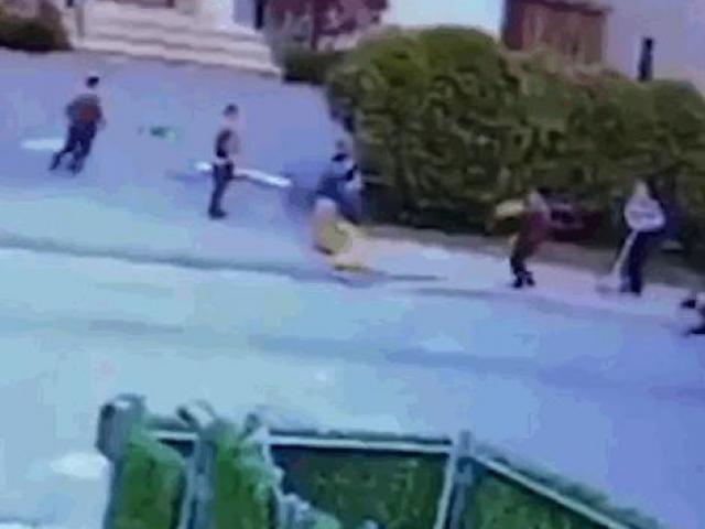 Cậu bé 3 tuổi bị chó pitbull tấn công kinh hoàng ngay giữa phố