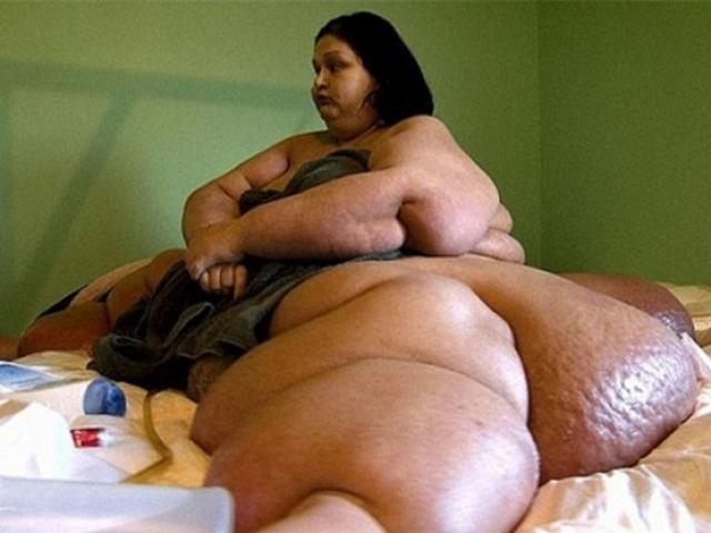 Bị nghi đè chết cháu vì quá béo, người phụ nữ giảm 362kg và diện mạo quá bất ngờ