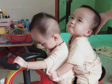 Hai bé Trúc Nhi-Diệu Nhi ngày trở lại bệnh viện