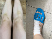 Giải trí - Chân Lý Nhã Kỳ thâm tím khi chơi gameshow, Hari Won còn đổ máu, phải tốn đống tiền