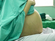 Bà bầu - Đi siêu âm y tá cứ thì thầm to nhỏ, mẹ bầu không ngờ sinh con chấn động thế giới