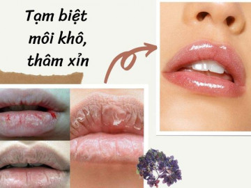 Tốn tiền mua son dưỡng mà môi vẫn khô, vì nàng chưa biết cách dưỡng môi căng mịn đó thôi!