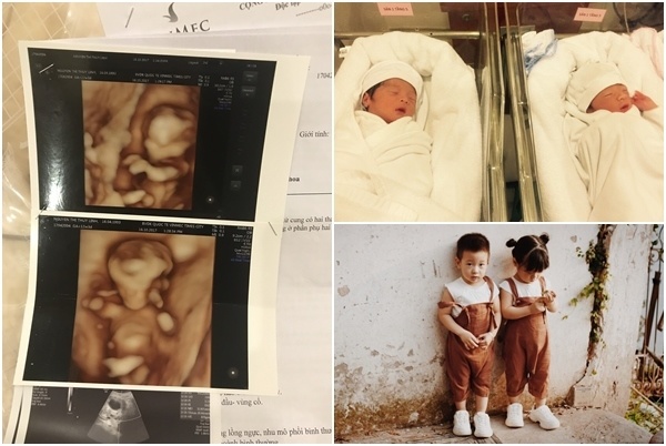 Mẹ trẻ thụ tinh nhân tạo cặp song sinh 1 trai 1 gái, 2 năm sau con đẹp như mẫu - 6