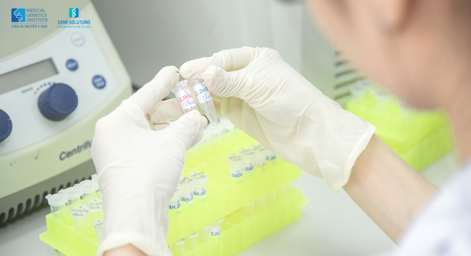 Cứ 300 người thì có 1 người mắc ung thư vú di truyền, làm sao để biết trước nguy cơ? - 2