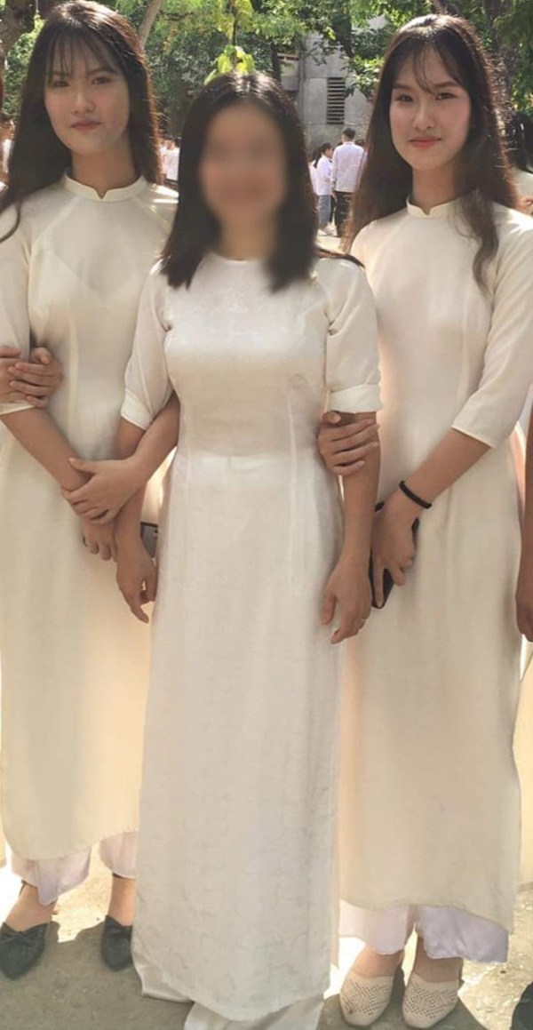 Cặp song sinh dính liền Cúc-An sau 17 năm tách rời: Cả hai vào đại học, tập sống xa nhau - 1