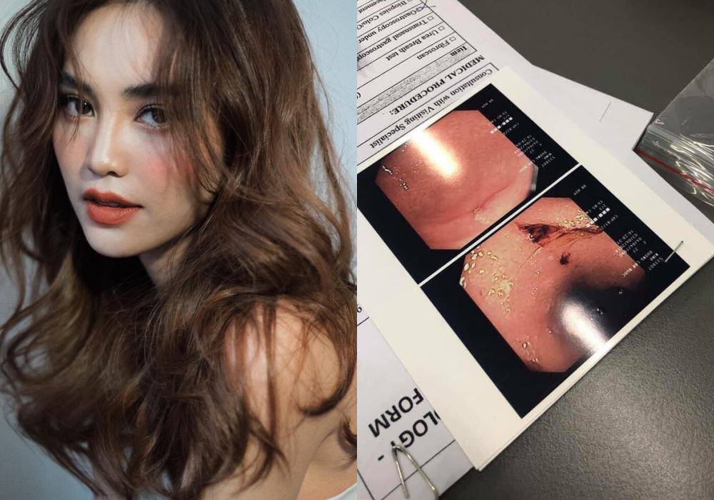 Suýt không thể sinh con vì ung thư, Lan Ngọc còn từng bị loét và chảy máu dạ dày - 6