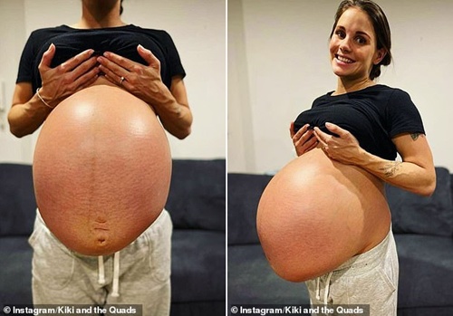 Cùng vợ đi siêu âm thai, chồng đơ người khi nhìn theo tay bác sĩ di chuyển - 3