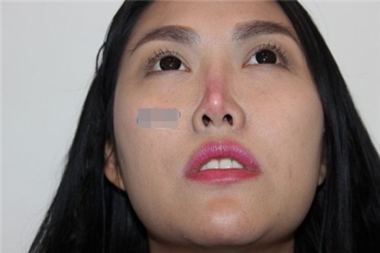 21 lần amp;#34;dao kéoamp;#34; bắt đầu từ tuổi 15, nhan sắc Phi Thanh Vân giờ lên xuống thất thường - 8