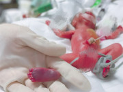 Bà bầu - Em bé sinh ra nặng vỏn vẹn 4 lạng, da trong suốt, ngày về nhà cả bệnh viện cùng khóc
