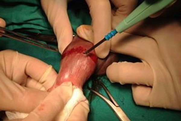 Hà Nội: Quan hệ tư thế lạ quá đà sau khi uống rượu, chồng amp;#34;gãy súngamp;#34; phải nhập viện - 3