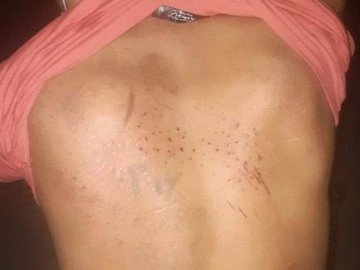 Bất ngờ lời khai của chủ quán bánh xèo Miền Trung bị tố bạo hành dã man 2 nhân viên