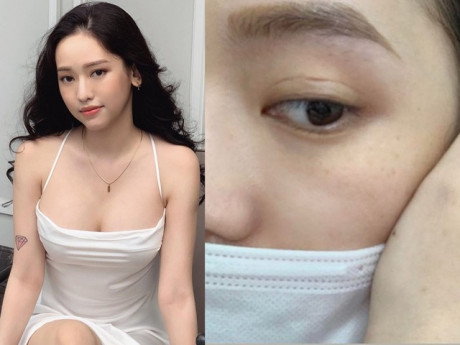 Tưởng có mặt hoa da phấn, Thuý Vi tự bóc khuyết điểm làn da già trước tuổi