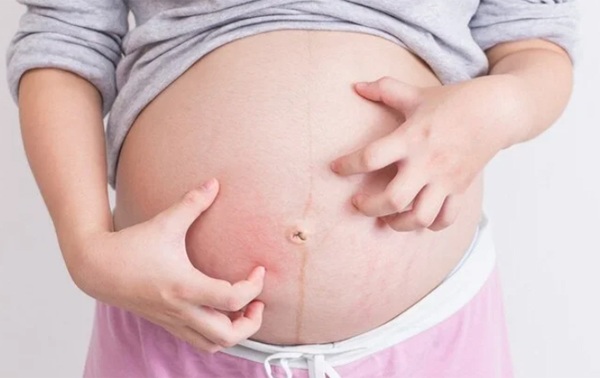 Mẹ bầu 8 tháng ngứa ngáy, đi khám bác sĩ vội vàng mổ bắt 2 con ngay - 1