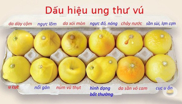 Vợ cư xử kỳ lạ khi gần gũi, chồng phát hiện vợ có khối u may mắn cứu được vợ - 3