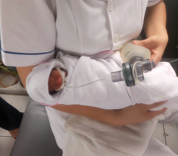 Sinh đôi nhưng 2 bé cách nhau 14 ngày, một bé mất, một bé nặng 4 lạng được cứu sống - 1