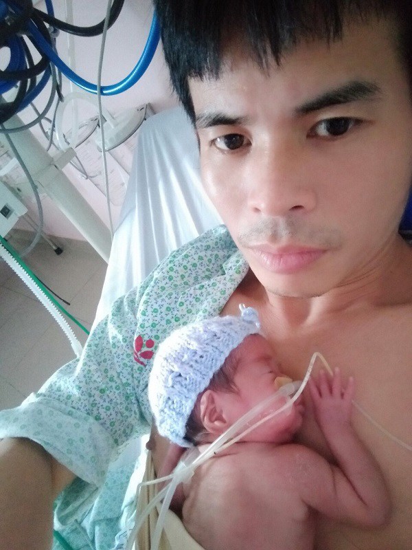 Sinh đôi nhưng 2 bé cách nhau 14 ngày, một bé mất, một bé nặng 4 lạng được cứu sống - 3