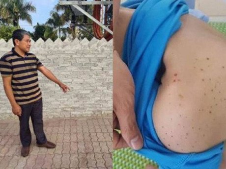 Vụ bé trai 14 tuổi bị hành hung ở Bắc Ninh: Người đầu tiên phát hiện nạn nhân nói gì?