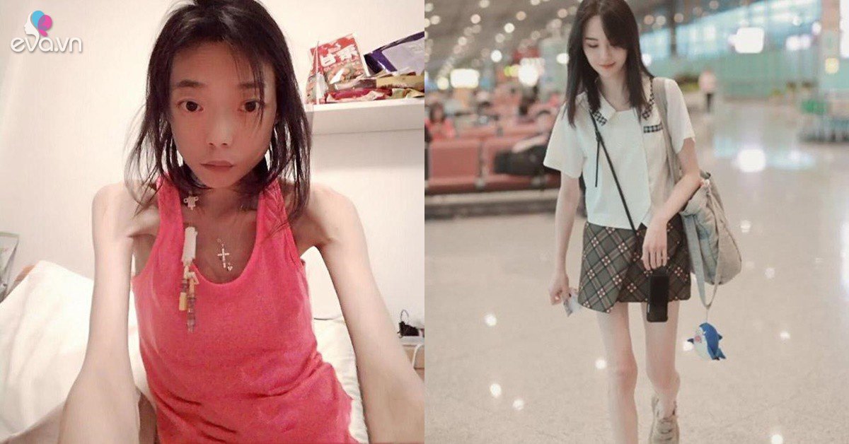 Mỹ nhân hủy hoại nhan sắc vì tình: Người già nua, kẻ bị vứt bỏ, chỉ còn da bọc xương
