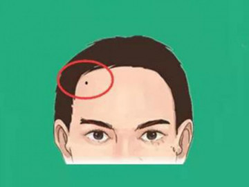 5 nốt ruồi vượng phu ích tử trên cơ thể, vợ có cả nhà thơm lây