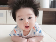 Làm mẹ - Tóc trẻ sơ sinh mọc dựng đứng kèm theo biểu hiện này cần đi khám bác sĩ