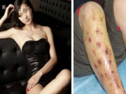 Sức khỏe - Nữ siêu mẫu vì thường xuyên ngồi kiểu này khiến cô bị gù lưng, giãn tĩnh mạch, viêm âm đạo