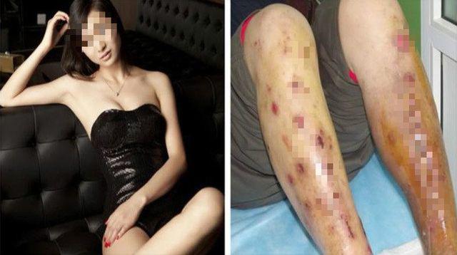 Nữ siêu mẫu vì thường xuyên ngồi kiểu này khiến cô bị gù lưng, giãn tĩnh mạch, viêm âm đạo - 1