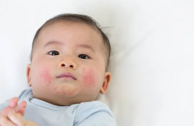 Mùa đông này, mẹ đã chọn được loại kem dưỡng ẩm phù hợp cho bé yêu chưa? - 1