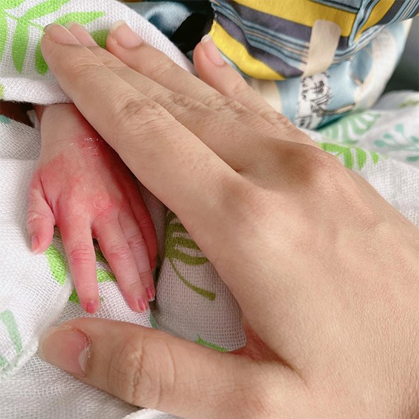Vợ bầu 8 tháng đã đẻ, nhìn bàn tay con gái sinh non 1,9kg của Mạc Văn Khoa mà thương - 2