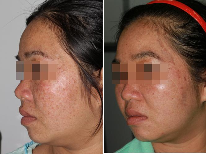 Lạ kỳ: 3 người trong một gia đình mang gen đột biến amp;#34;chỉ sống được về đêmamp;#34; - 2