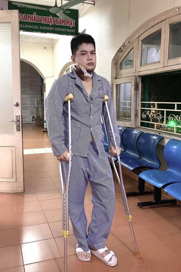 Bệnh khiến thí sinh hóa thân Hà Hồ trong Gương Mặt Thân Quen bị amp;#34;ănamp;#34; xương hàm có nguy hiểm? - 2