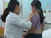 Sức khỏe - Bé gái 6 tuổi cao bất thường, ngực phát triển mạnh, mẹ bàng hoàng khi biết nguyên nhân