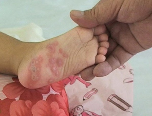 Đồ vật trong phòng ngủ bẩn hơn bồn cầu 1.000 lần, nếu bạn ngủ không ngon hãy kiểm tra nó - 3