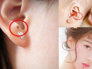 Người may mắn sở hữu 3 nốt ruồi này đích thị đại gia, càng già càng phất
