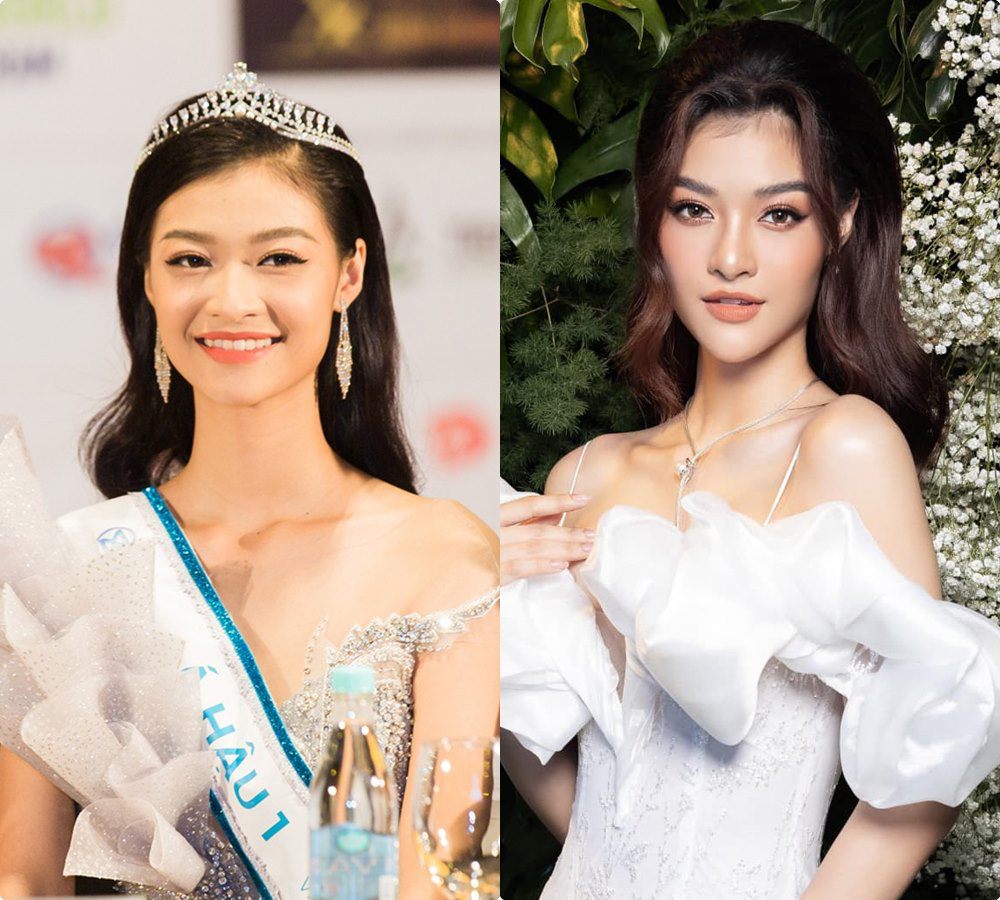 Đăng quang mới được 1 năm, Kiều Loan dính nghi vấn sửa từ mặt cho tới cả amp;#34;tâm hồnamp;#34; - 8