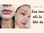 Làm đẹp - Da nứt nẻ ngày lạnh là vì nàng chưa cập nhật 5 chiêu trị khô da trong 1 tuần này