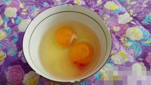 Trứng bổ mấy cũng hóa độc nếu có 4 biểu hiện này, vì tiếc cố ăn dễ phải nhập viện - 3